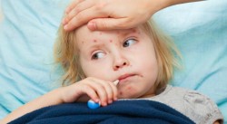 Spitalul Clinic Județean de Urgență Arad a suplimentat numărul paturilor pentru copiii diagnosticați cu rujeolă

