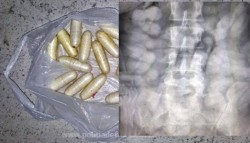 Cetăţeni brazilieni, arestaţi de DIICOT după ce s-a descoperit că transportau 2 kg de cocaină în stomac