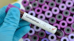 11 cazuri confirmate de coronavirus (COVID-19), pe teritoriul României