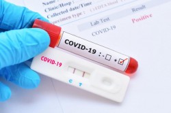 29 de cazuri noi de pacienţi infectaţi cu coronavirus în Arad în ultimele 24 de ore