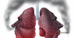 Respirația este viață! Alege să ai plămâni sănătoși! Ziua Mondială de Luptă împotriva Bronhopneumopatiei Cronice Obstructive (BPOC) – 15 Noiembrie 2023
