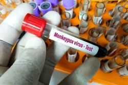 După pesta porcină, ovină și gripa aviară, a sosit rândul variolei maimuței. Primul caz de infectare cu mpox din Europa, confirmat de Suedia. OMS a declarat epidemia o urgență globală

