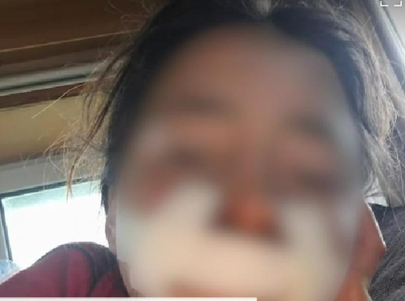 Viață chinuitoare pentru doi frați din Bârsa, care au fost bătuți și înfometați de părinți. Tatăl a cusut rana unuia dintre copii cu o sfoară. Minorii au obținut ordin de protecție împotriva ambilor părinți