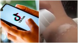 Deodorantul spray pe piele, o nouă provocare pe TikTok, a ajuns în România. Tinerii se aleg cu grave leziuni ale pielii și cicatrici pe viață

